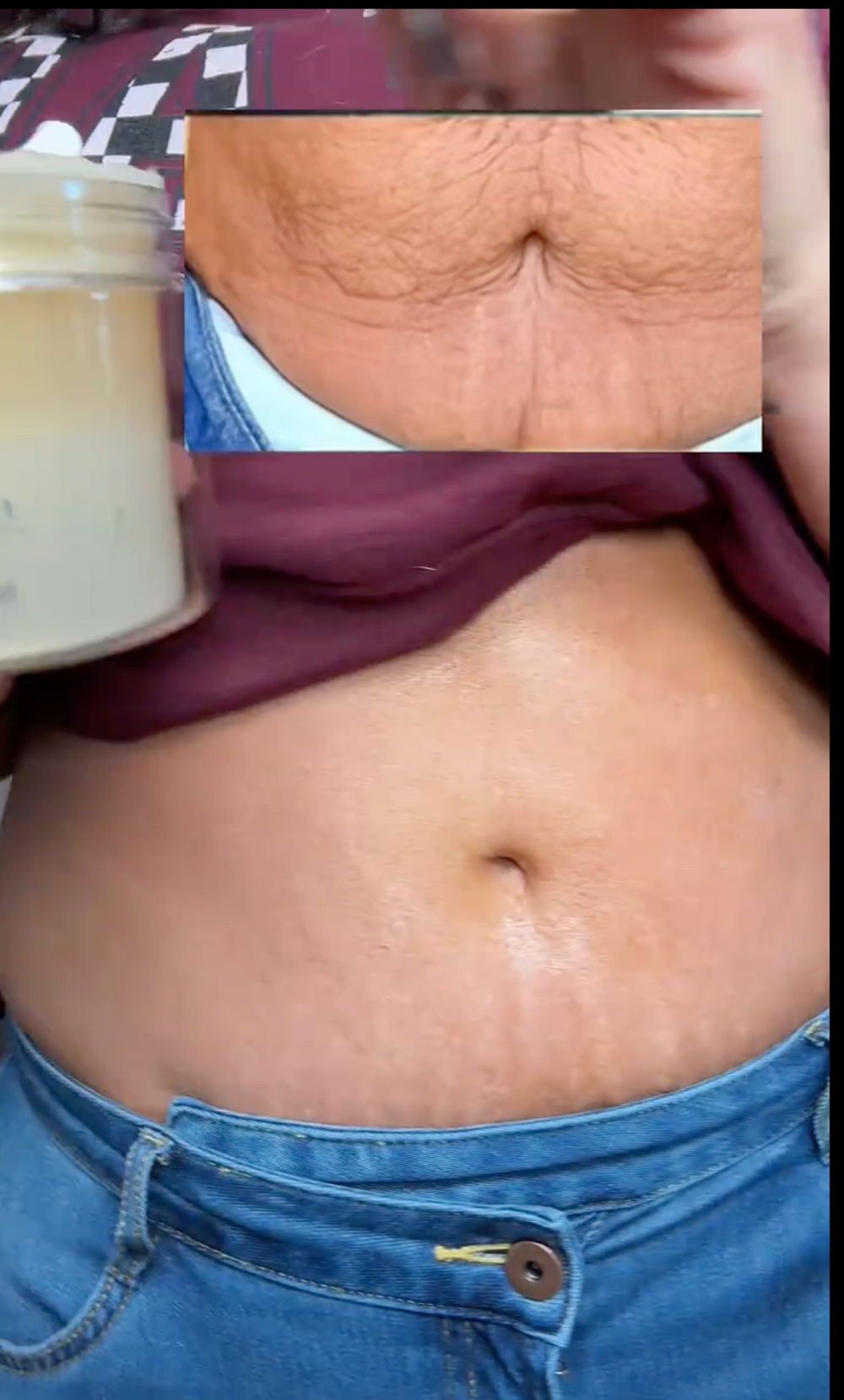 <p><strong>The Confidence-Boosting Glow You've Been Waiting For</strong></p>